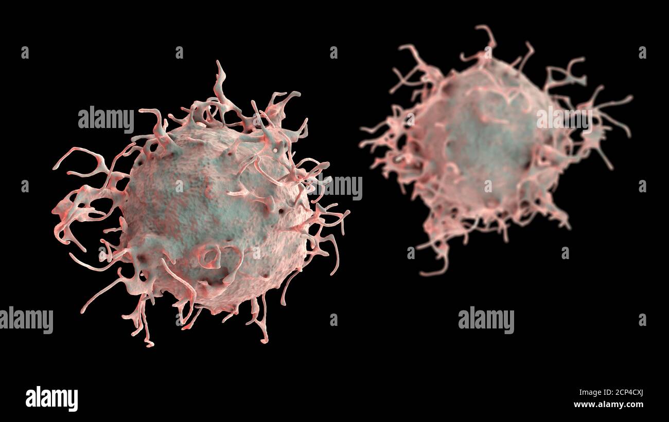 Cellula di cancro della pelle, illustrazione del calcolatore. Foto Stock