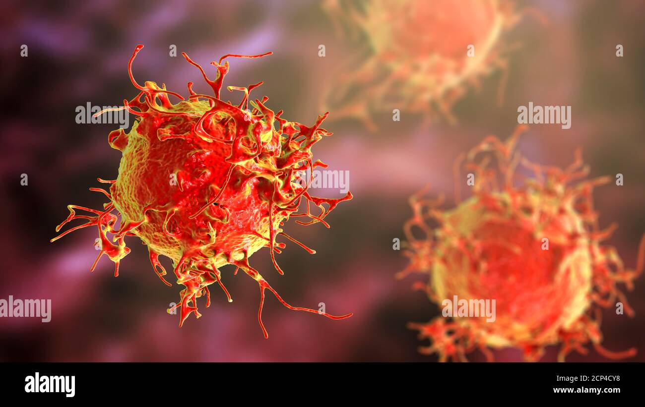 Cellula di cancro della pelle, illustrazione del calcolatore. Foto Stock