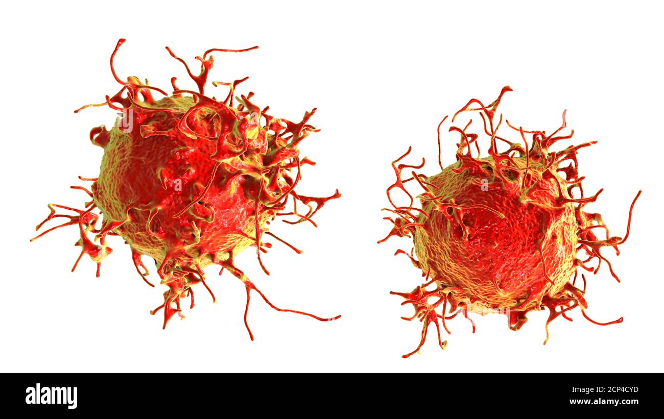 Cellula di cancro della pelle, illustrazione del calcolatore. Foto Stock