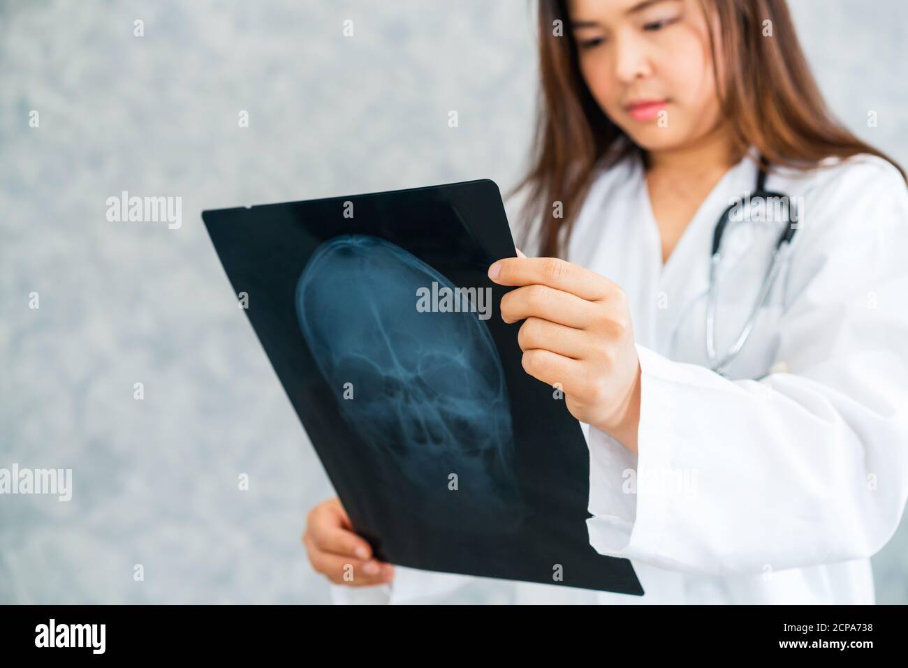 Giovani donne medico guardando il paziente xray film di testa o malattia del cervello in ospedale. Assistenza sanitaria e medica il concetto di servizio. Foto Stock