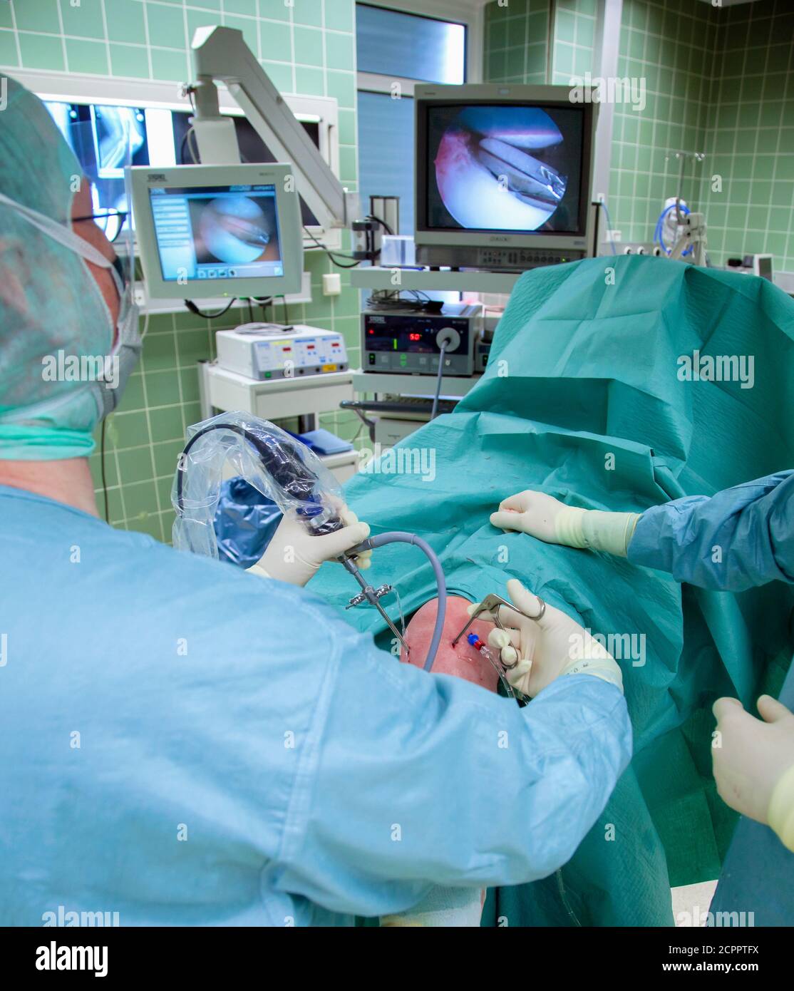 Essen, Nord Reno-Westfalia, Germania - Ospedale. Intervento chirurgico minimamente invasivo sull'articolazione del ginocchio. Il paziente viene utilizzato senza tagli maggiori. Il Foto Stock