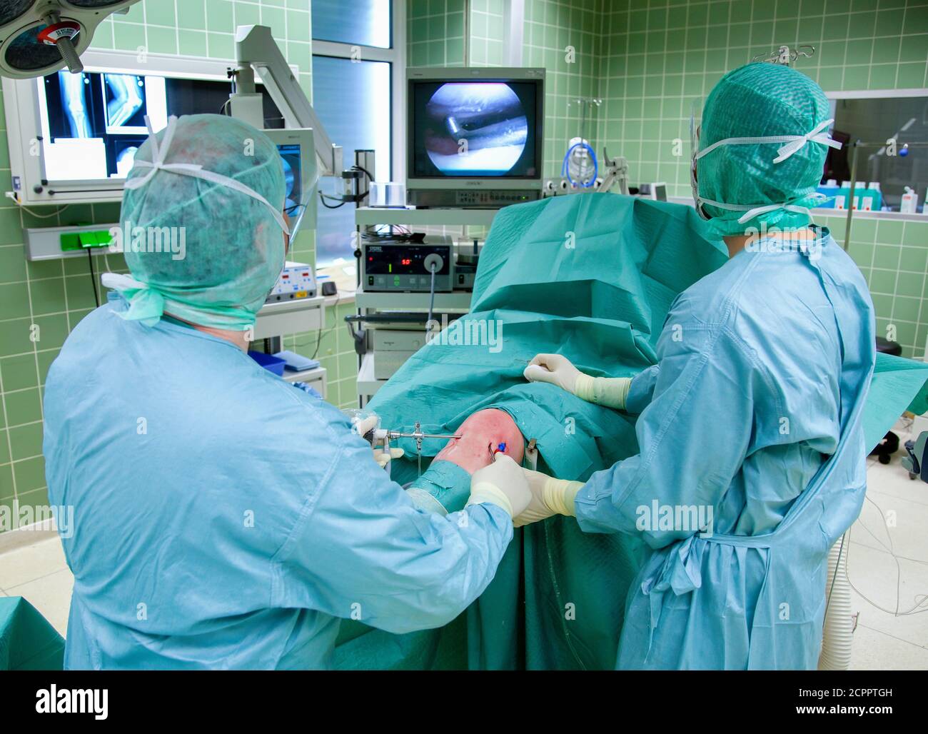Essen, Nord Reno-Westfalia, Germania - Ospedale. Intervento chirurgico minimamente invasivo sull'articolazione del ginocchio. Il paziente viene utilizzato senza tagli maggiori. Il Foto Stock