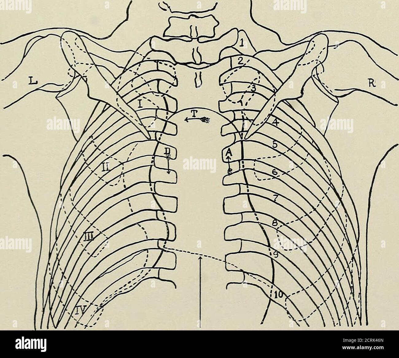 . Röntgen raggi ed elettroterapeutici : con capitoli su radioterapia e fototerapia . Fig. 185.-Aneurismo dell'aorta discendente (vista posteriore). Piastra applicata contro la schiena del torace. Fig. 1S6. - traccia fotographica della stessa. Linee pesanti, contorni del cuore normale; linee tratteggiate, dilatazione della discesa (D--, aorta ascendente; T -&lt; , aorta trasversale. Foto Stock