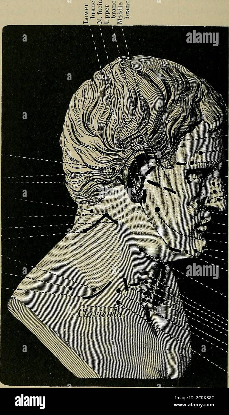 . Un trattato pratico sulla diagnosi medica per studenti e medici. La superficie del piede. Alleata ai riflessi è la cosiddetta contrazione paradossale di West-phal. Questo consiste in uno spasmo persistente del muscolo quando i suoi due attacchi sono improvvisamente avvicinati insieme. Si osserva più spesso nei muscoli peroneali della gamba, e può essere suscitato flettendo il piede in posizione dorsale. Si trova più frequentemente in condizioni variofunzionali, ed è stato osservato anche in paralisi agitans. 308 ESAME DEL SISTEMA NERVOSO. Nutrizione dei muscoli. Accanto al fu Foto Stock