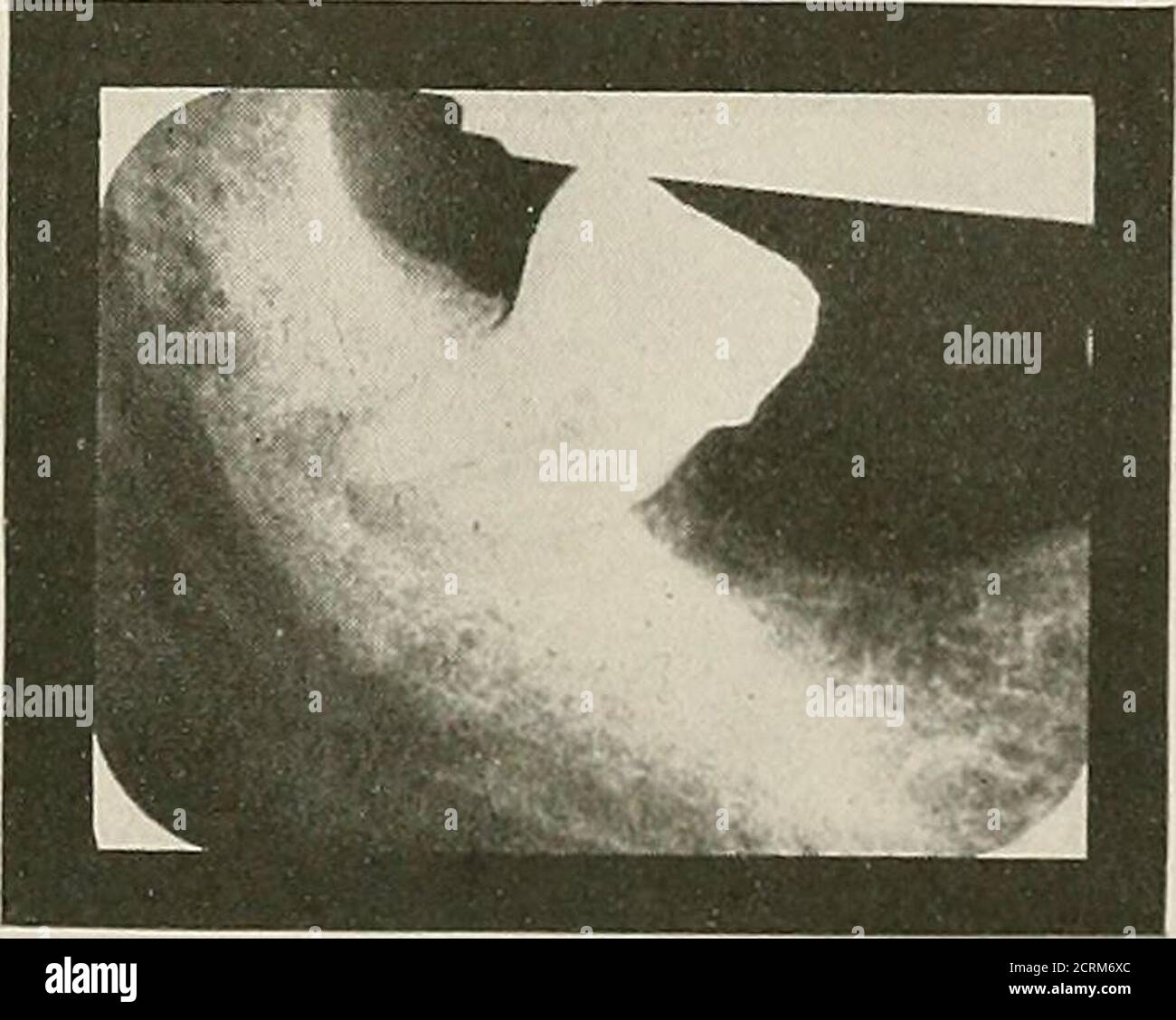 . Diagnosi elettro-radiografica; un libro sul test elettrico per la vitalità della polpa, che dà al tecnico del suo uso in dettaglio e che presenta prove cliniche della sua assoluta necessità alla diagnosi dentale . Fig. 134.. Fig. 135. 154 conclusione DELLA DIAGNOSI ELECTEO-RADIOGEAPHIC il mio obiettivo nel capitolo lias è stato quello di dimostrare il test elettrico necessario per una corretta ed affidabile interpredazione delle radiografie e quindi necessario all'arte della diagnosi dentale. I Conld andare avanti indefinitamente citingcase dopo caso, appena come si potrebbe andare avanti indefinitamente citingcase dopo caso per dimostrare l'utilità della r Foto Stock