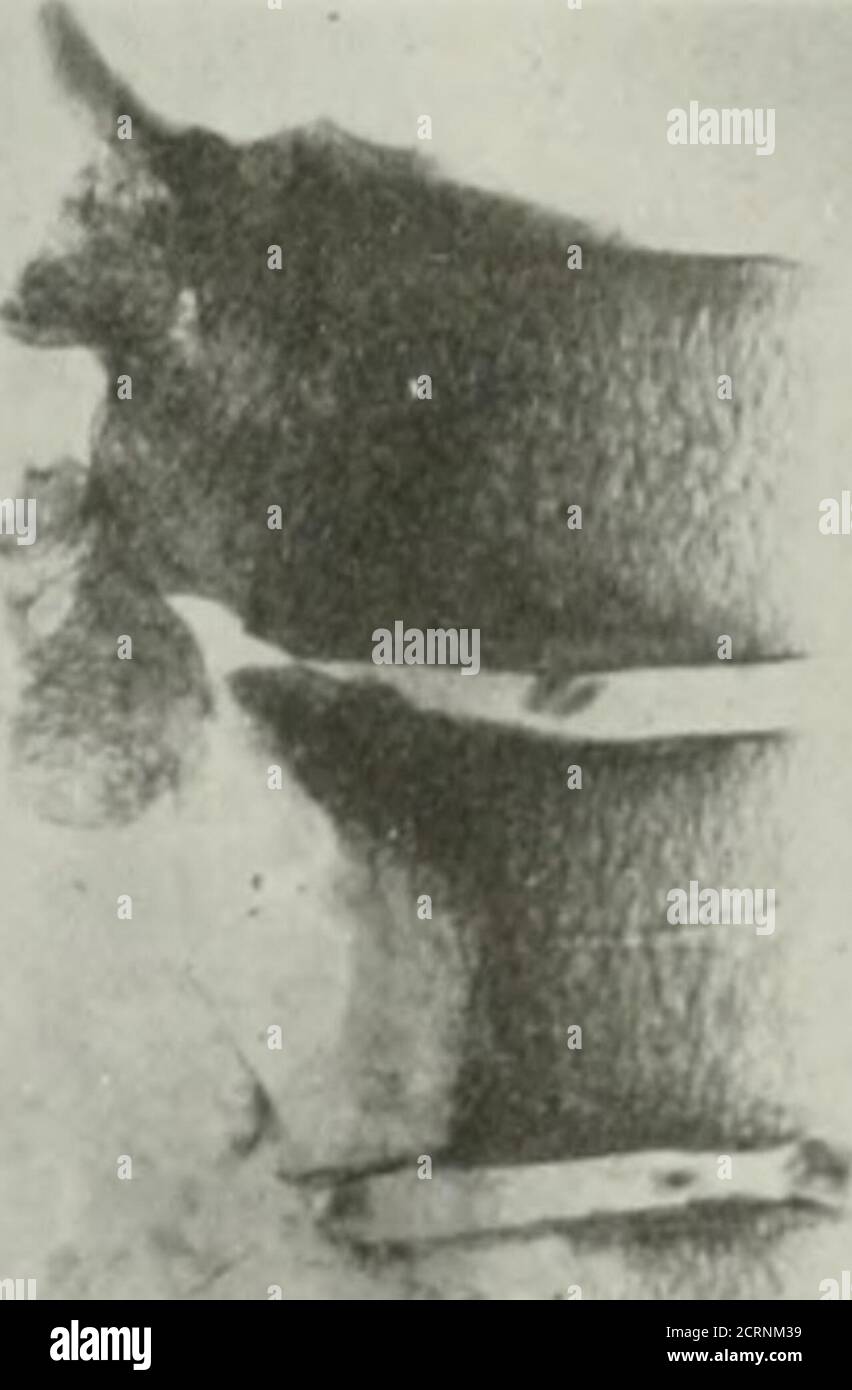 . La rivista americana di roentgoenologia, radioterapia e medicina nucleare . Foto Stock