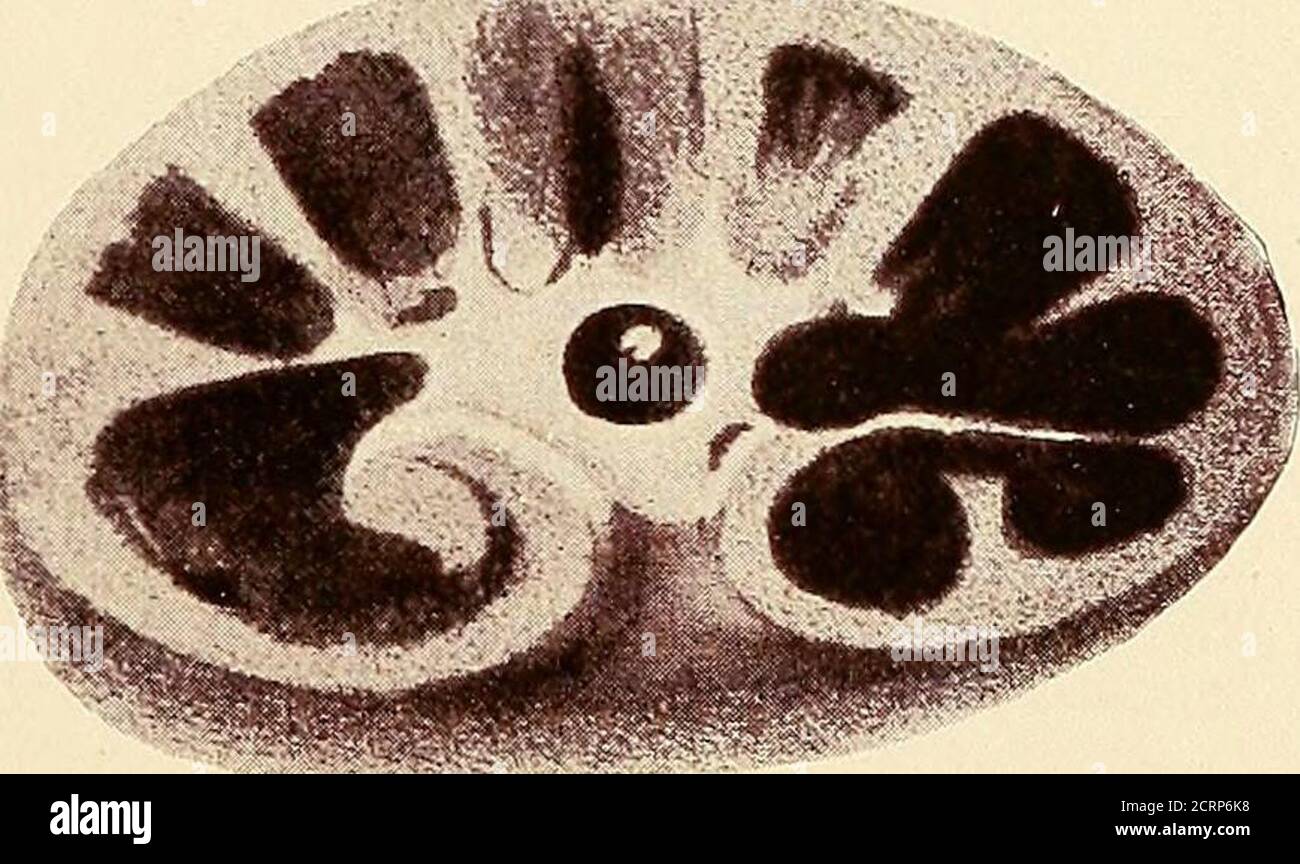 . Un trattato sull'ostetricia per studenti e professionisti . FIG. 4. Foto Stock