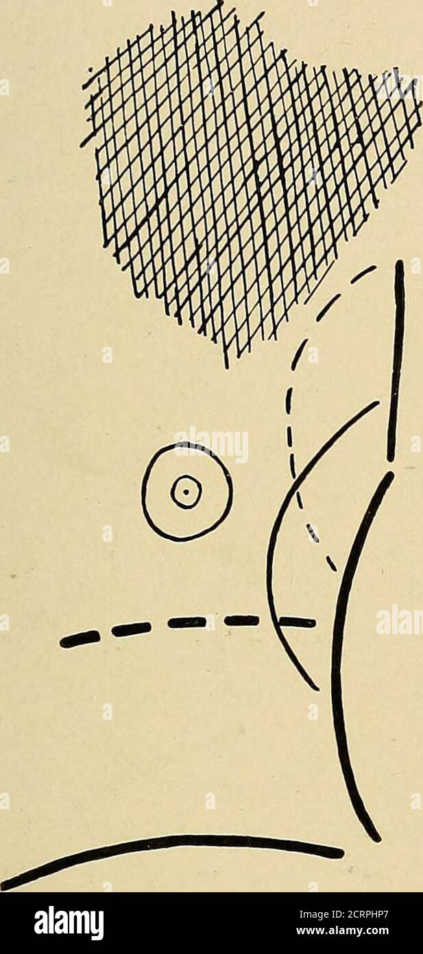 . I raggi Roentgen in medicina e in chirurgia come ausilio nella diagnosi e come agente terapeutico : destinati all'uso di medici e studenti . t possono essere dovuti alla contrazione del polmone, il cui risultato sarebbe quello di tirare il cuore verso il formerorgano ; oppure può risultare dalla maggiore escursione del diaframma su un lato rispetto all'altro; per se c'è una differenza marcata nello spostamento del diaframma nei due lati del petto, l'effetto wouldbe di spingere il cuore più lontano verso il lato malato che wouldnaturally va fatto entrambi i lati del diaframma si muovono normalmente Foto Stock