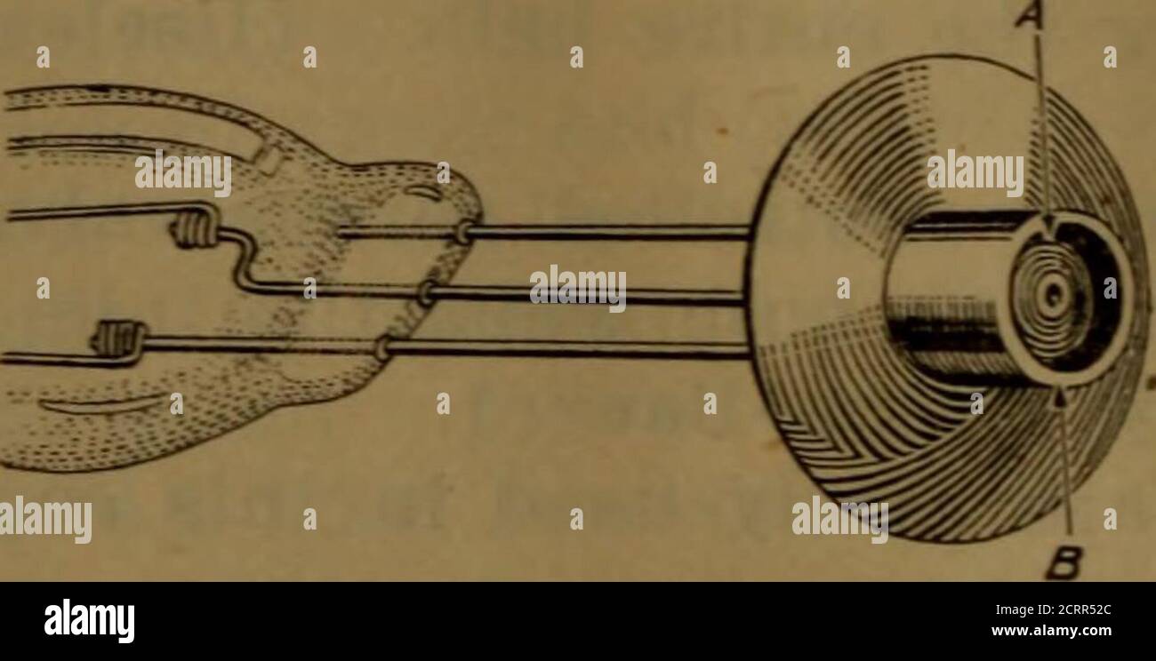 . Manuale di raggi X : Esercito degli Stati Uniti . ndis sempre verso grandi quantità di ioni e un calo consequente nella penetrazione a meno che la corrente sia notevolmente aumentata quando un rifornimento ancora più grande è sviluppato, squello non ci è auto-protezione automatica del tubo. Wehnelt ha trovato che un nastro di platino rivestito con calcari consentirebbe il trasferimento di corrente attraverso un alto vuoto a tensioni moderate. Diversi tentativi di utilizzare tale acathode per i tubi di Roentgen non sono stati riusciti, e la nomodificazione del tubo standard è apparsa fino a quando non è stato wasfound da Richardson e altri che gli elettroni wereemned da metalli caldi. I simples Foto Stock