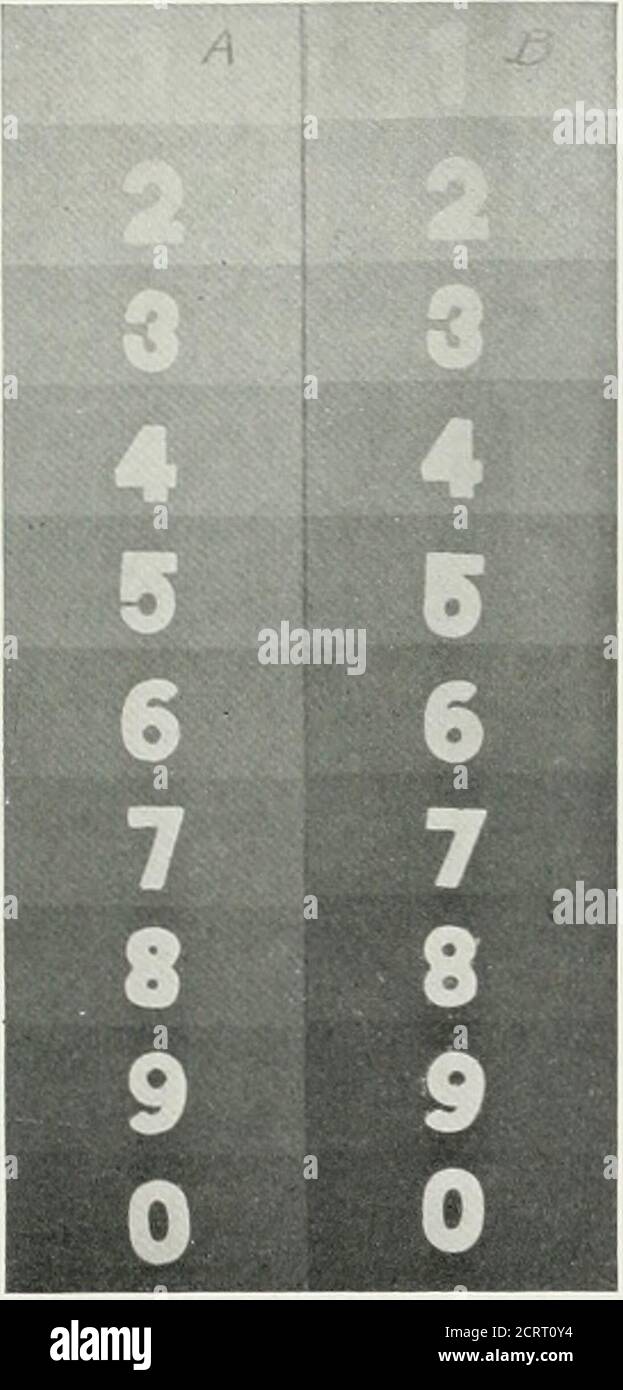 . La rivista americana di roentgoenologia, radioterapia e medicina nucleare . Foto Stock