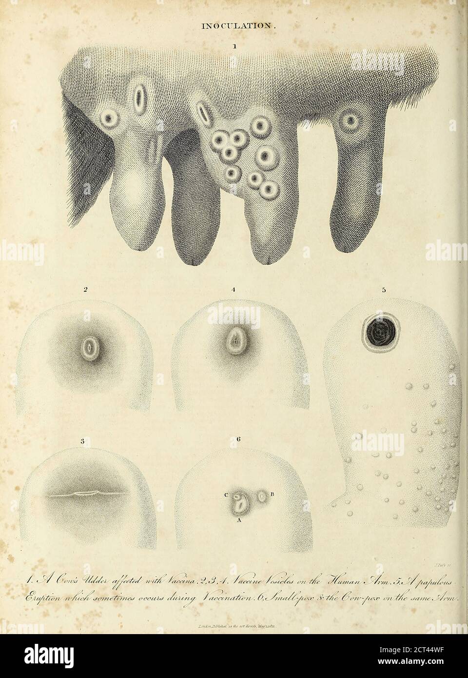 Inoculazione contro il virus del vaiolo e altre varietà di vaiolo incisione su copperplate dell'Enciclopedia Londinensis OR, dizionario universale di arti, scienze e letteratura; Volume XI; a cura di Wilkes, John. Pubblicato a Londra nel 1812 Foto Stock