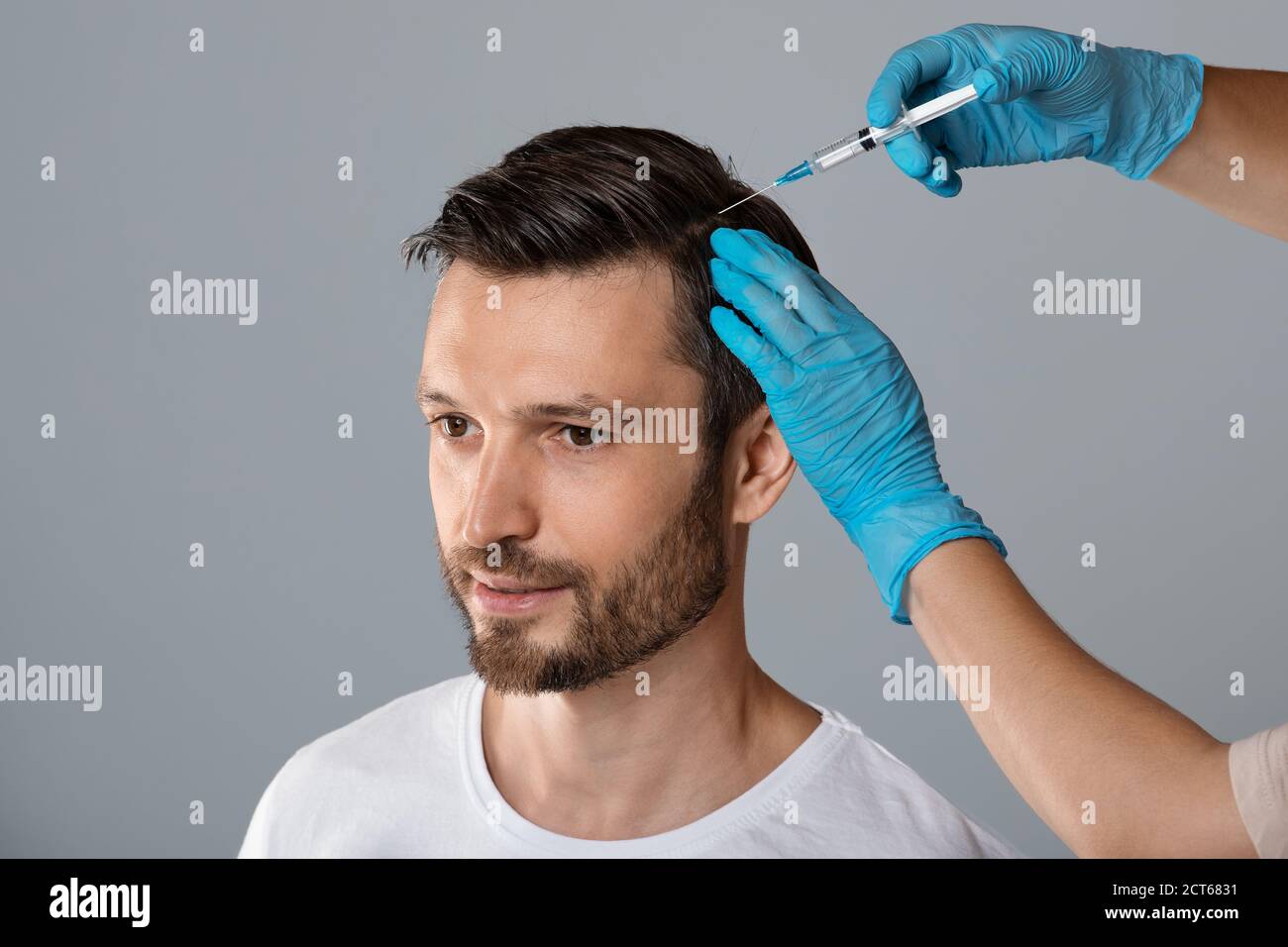 Mesoterapia per capelli. Uomo che riceve iniezioni nella testa Foto Stock