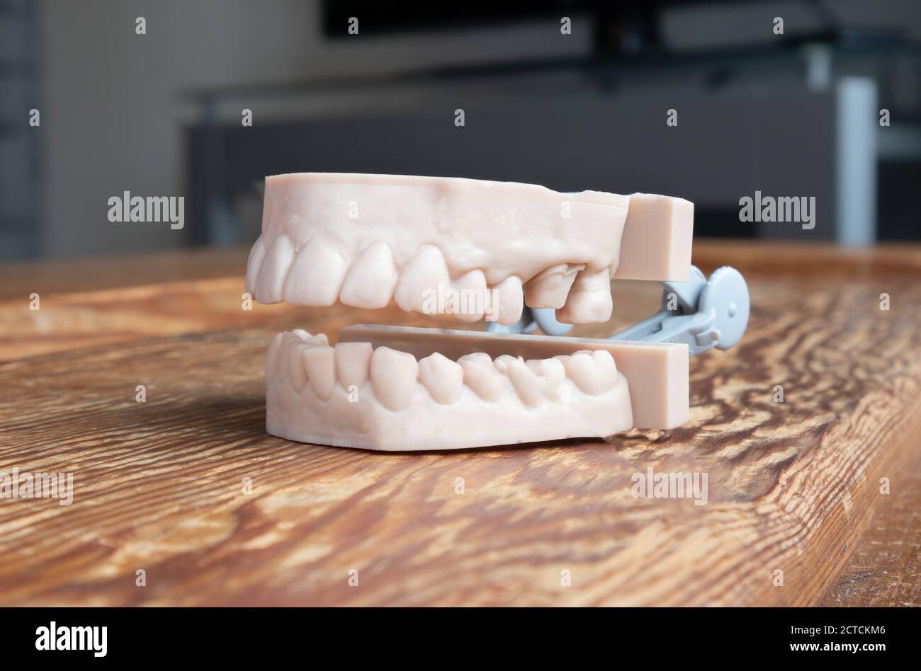 Denti stampati da una stampante 3d. Mascella superiore e inferiore di un adulto. Utilizzato per creare allineatori, guardie notturne, bretelle, corone, protesi dentarie e guide chirurgiche. Foto Stock