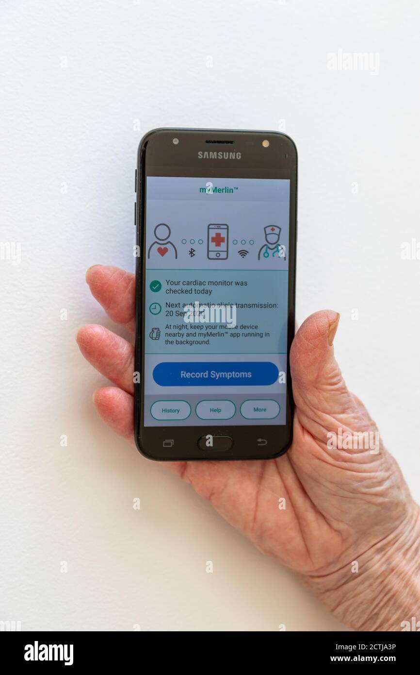 Smartphone che trasmette i segnali del ritmo cardiaco di una persona da un registratore di loop cardiaco impiantato per il monitoraggio remoto da parte di esperti. Tecnologia medica Foto Stock