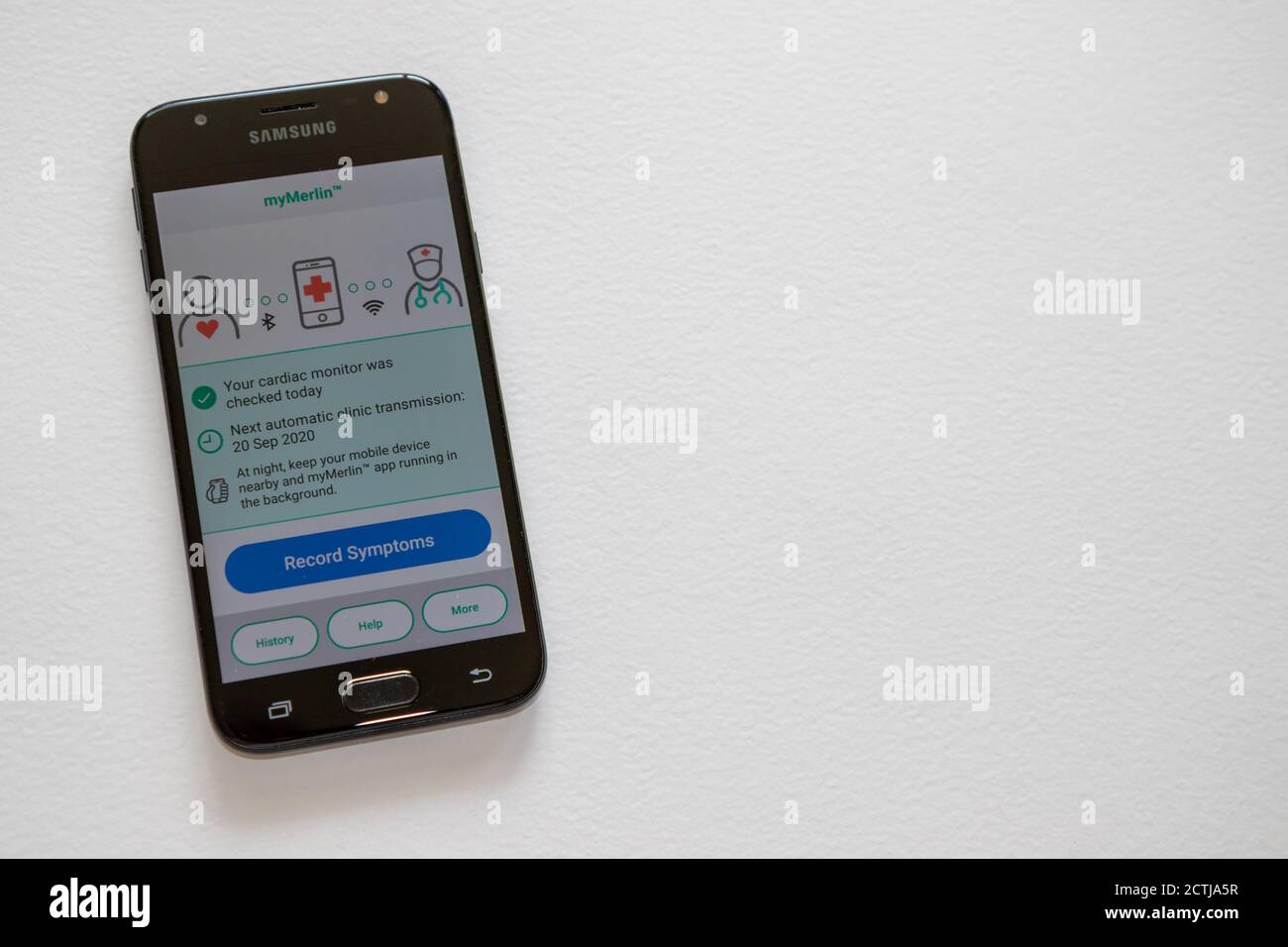 Smartphone che trasmette i segnali del ritmo cardiaco di una persona da un registratore di loop cardiaco impiantato per il monitoraggio remoto da parte di esperti. Tecnologia medica Foto Stock