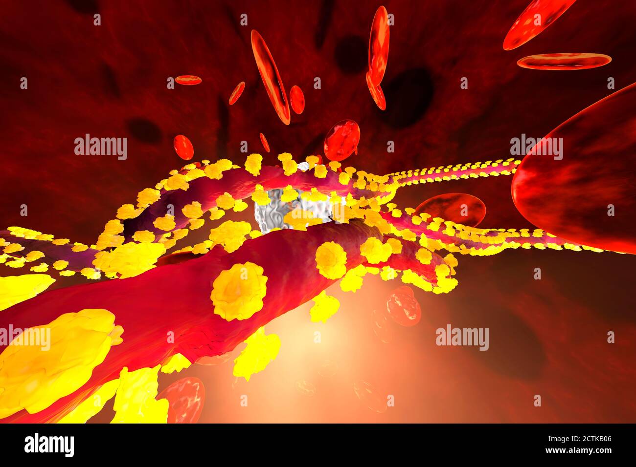 Resa tridimensionale del virus Ebola che combatte con i globuli bianchi in flusso sanguigno Foto Stock