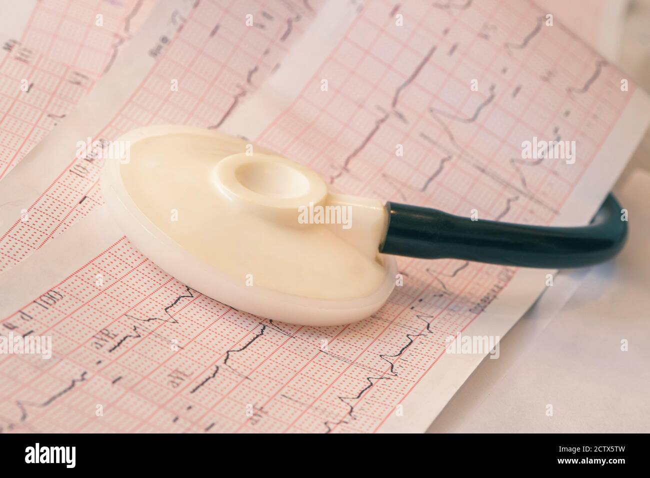 il fonendoscopio si trova sulla tabella della frequenza cardiaca. Cardiogramma medico per l'esame di malattie cardiache. Foto Stock