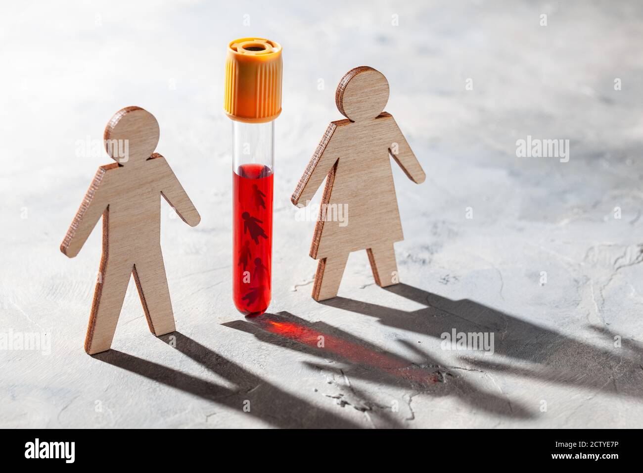 Bambino dalla provetta. Concimazione. IVF. Cambiare il DNA di un futuro bambino, bambina per ordinare. Foto Stock