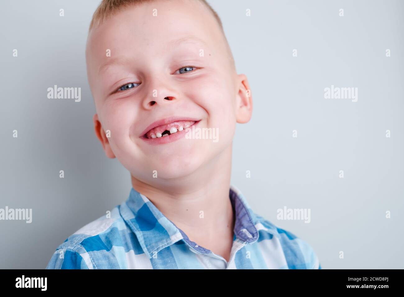 Sorridi il bambino senza il dente superiore del bambino. Un buco nel sorriso di un bambino. Cheerful concept.Health Care, igiene dentale. Foto Stock
