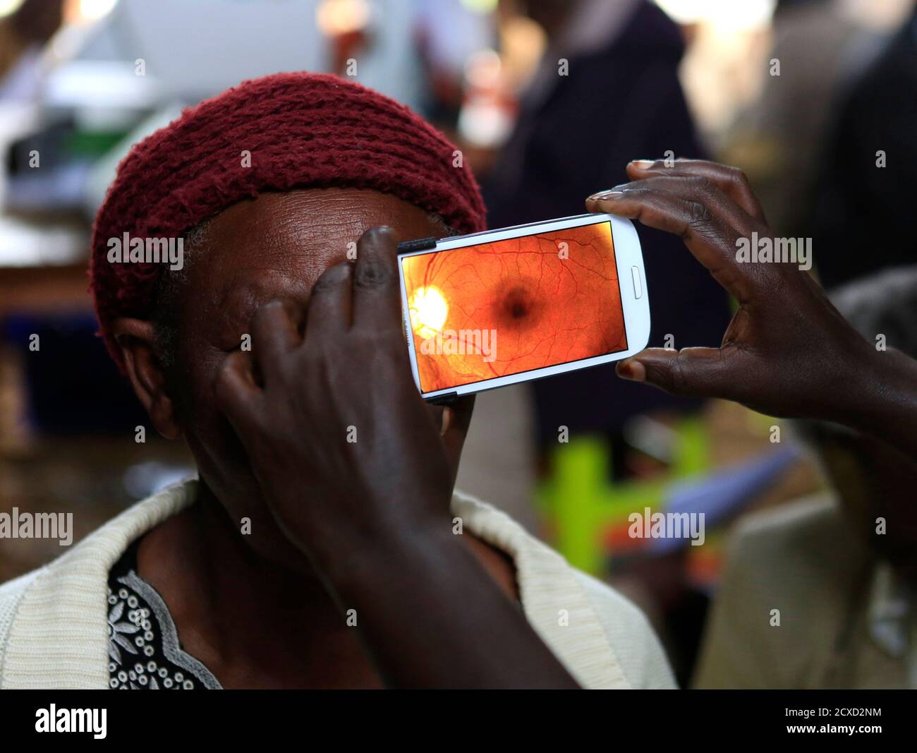 Una donna viene sottoposta ad un esame oculare utilizzando uno smartphone  in una clinica temporanea dal Centro Internazionale per la Salute degli  occhi a Olengo-uruone nel Mau Summit 350km (217 miglia) ad