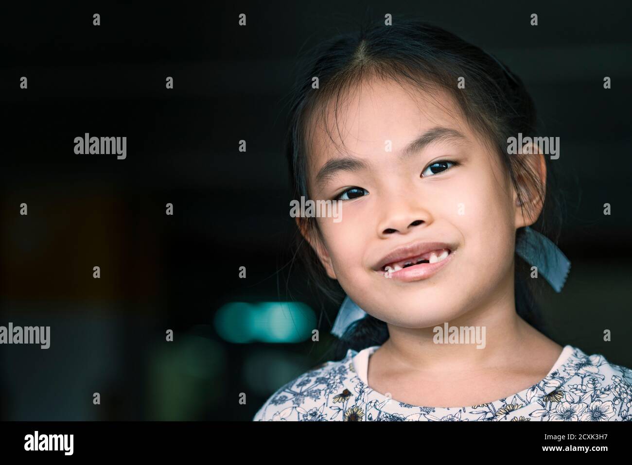 Bambino asiatico ragazza mancante dente anteriore, faccia sorridente. Primo piano su cute faccia, spazio per la copia e la progettazione. Occhi che guardano la fotocamera. Foto Stock