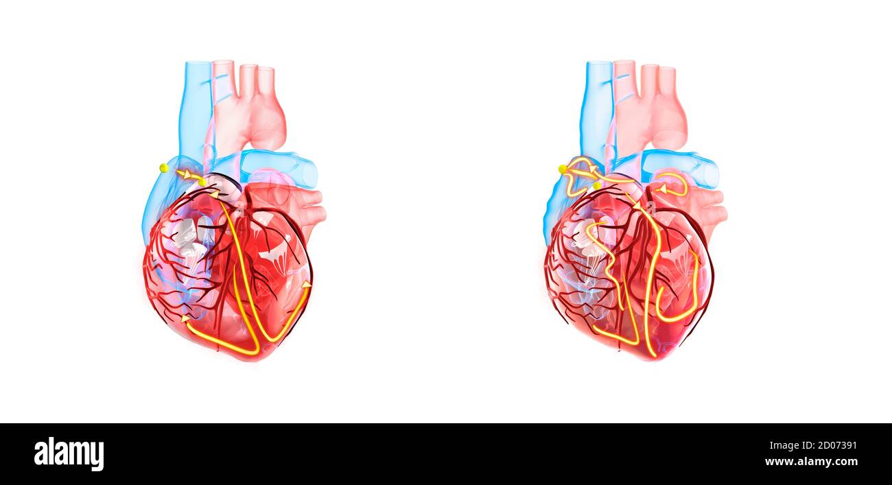Cuore umano e sistema elettrico, illustrazione 3d. Le linee gialle mostrano il sistema elettrico (conduzione) del cuore. Il cuore di RIG Foto Stock