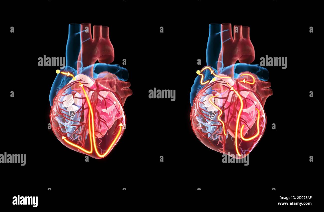 Cuore umano e sistema elettrico, illustrazione 3d. Le linee gialle mostrano il sistema elettrico (conduzione) del cuore. Il cuore di RIG Foto Stock
