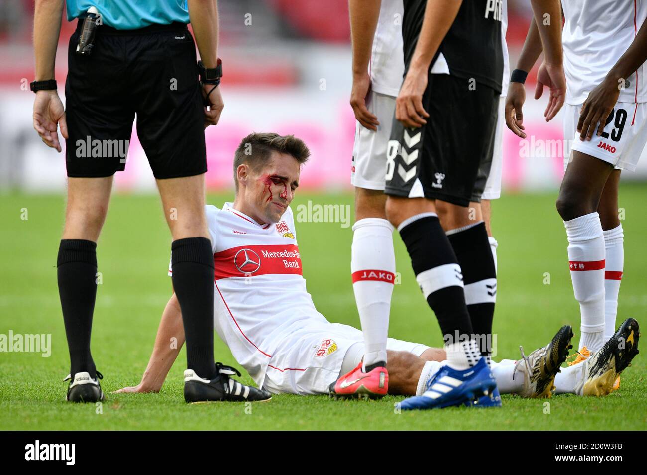 Philipp Klement VfB Stuttgart è ferito a causa di una ferita alla testa sanguinante, Mercedes-Benz Arena, Stoccarda, Baden-Württemberg, Germania, Europa Foto Stock