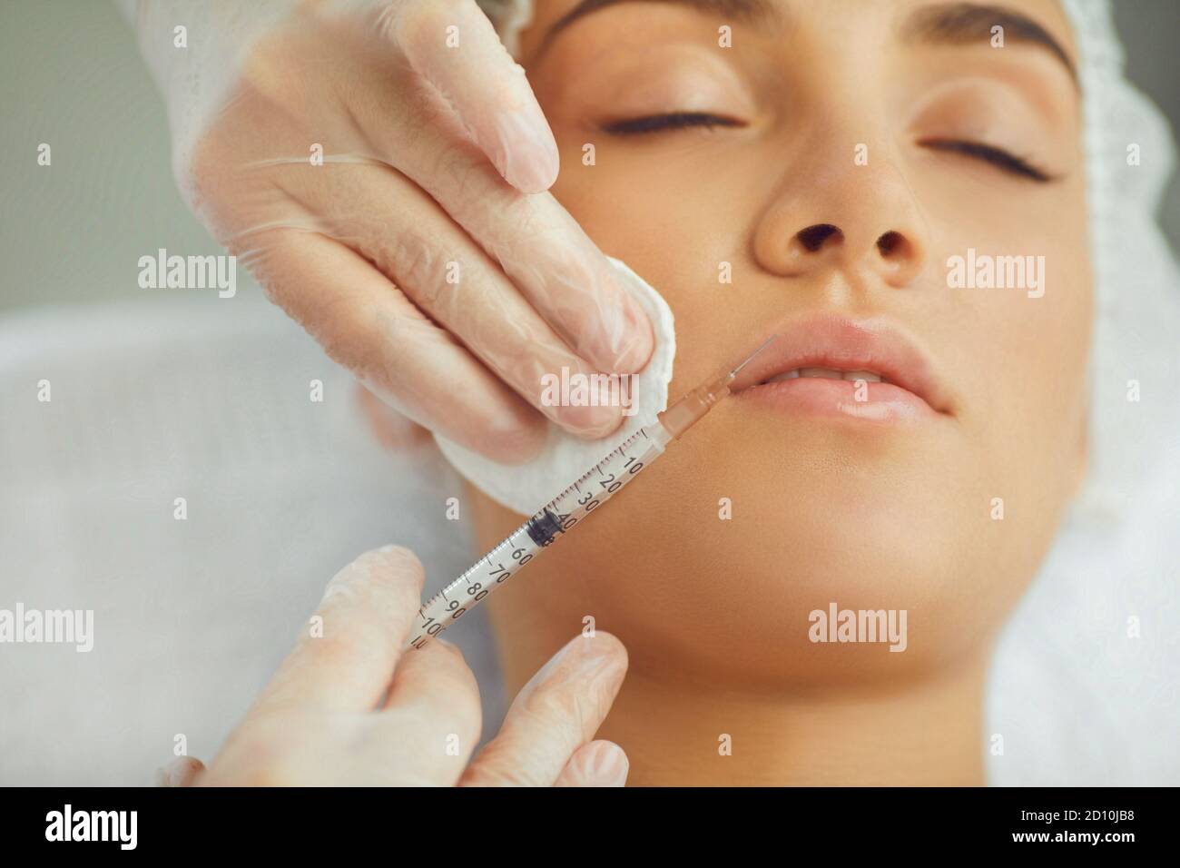 I terapisti iniettano mani botox riempitivo per correggere labbro superiore di giovane donna Foto Stock