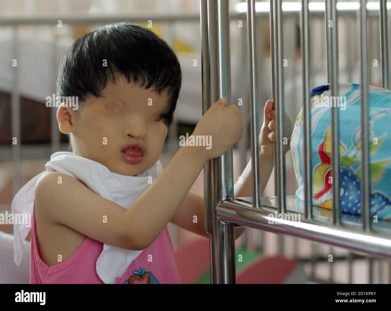 Vietnamese Defoliant Agent Orange Victim Tran Huynh Thuong Sinh 4 Is Seen At The Peace Village In Ho Chi Minh City In This September 15 06 File Photo Brain Damaged Babies And Children