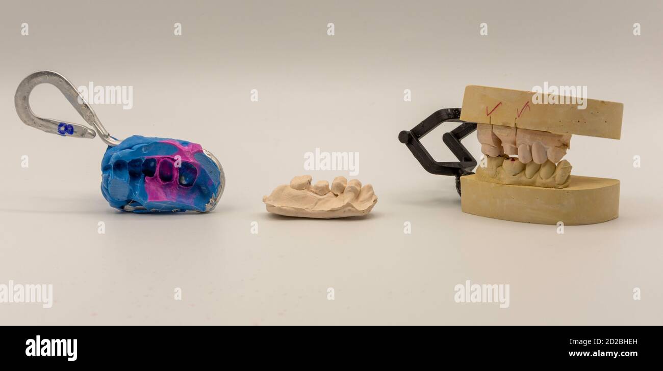 Tre pezzi di impressioni dentali Foto Stock