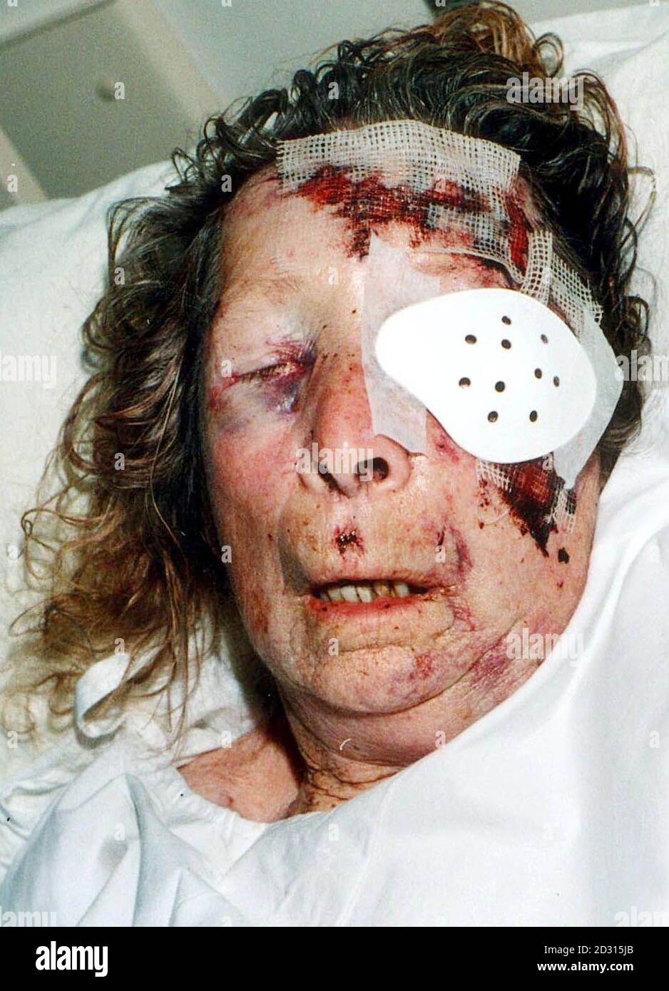 Il pensionato di 87 anni Edith Chapman, che si trovava in una condizione critica al Stepping Hill Hospital di Stockport, dopo un brutale attacco da parte di un ladro il 1/9/00. Foto Stock