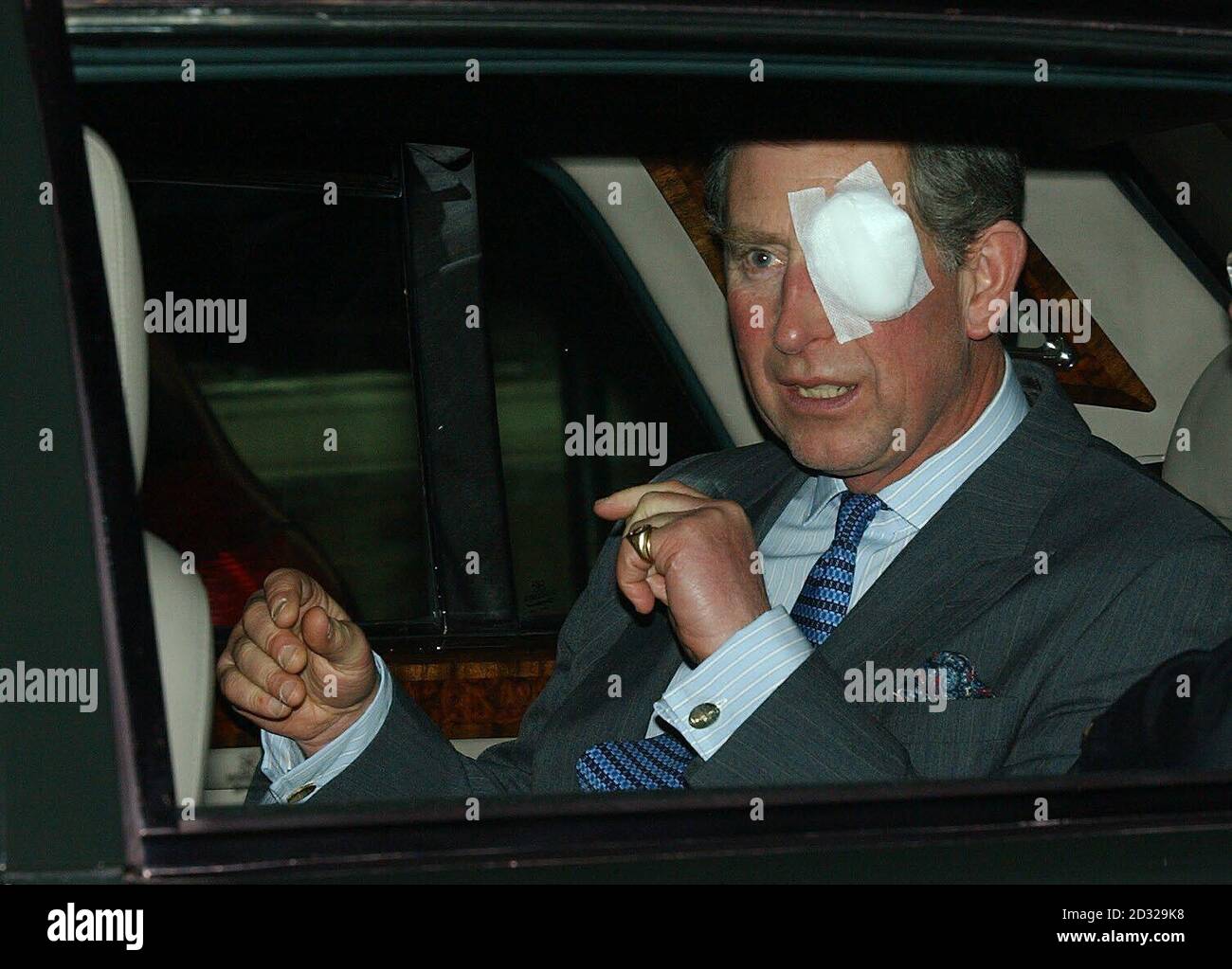 Il Principe del Galles indossa un vestito sopra un occhio sinistro ferito - sostenuto dopo avere ottenuto la polvere nel suo occhio mentre sega un albero nel suo giardino durante il fine settimana - parte dopo aver visitato una casa residenziale a Twickenham, Londra sud-occidentale. *.... gestito dal Benevolent Fund dell'Entertainment Artiste. Foto Stock