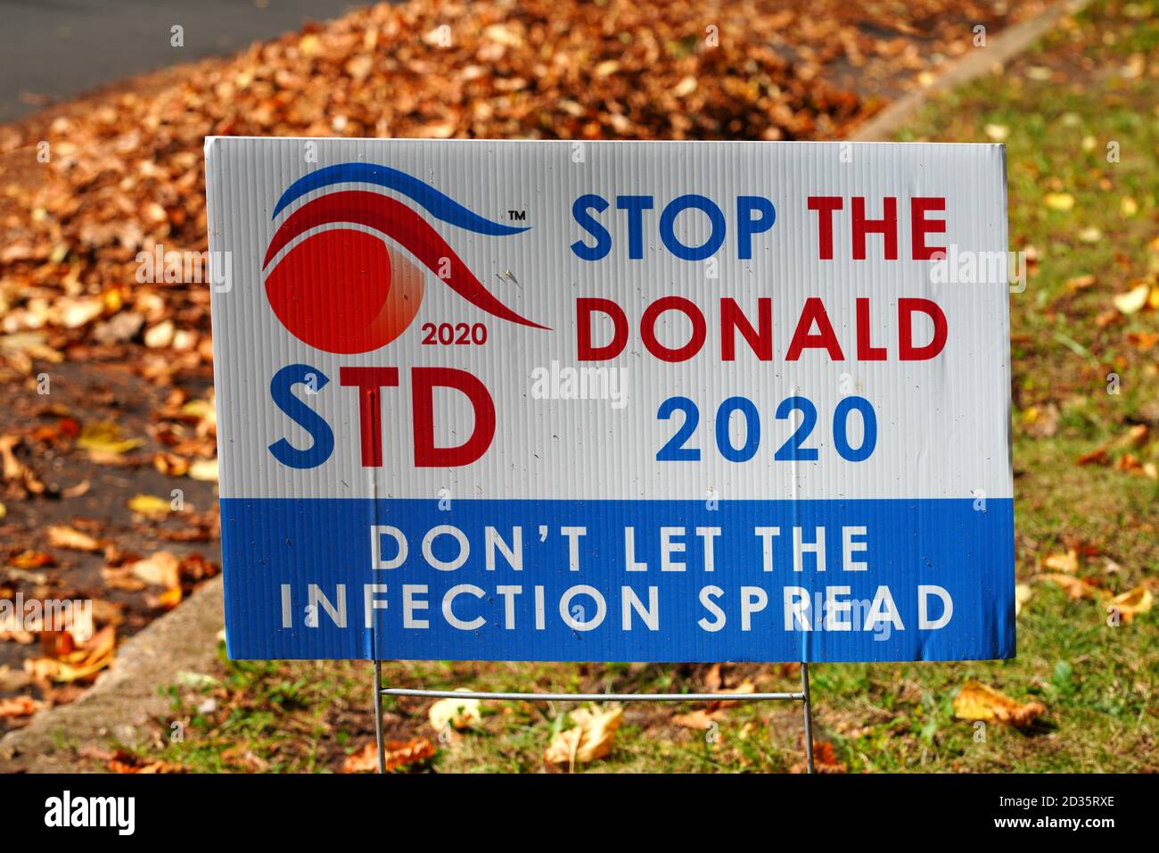 PRINCETON, NJ -2 OTT 2020- Vista di un cartello politico sul prato che dice STD fermare il Donald 2020 durante la campagna presidenziale del 2020 sulla strada a New JE Foto Stock