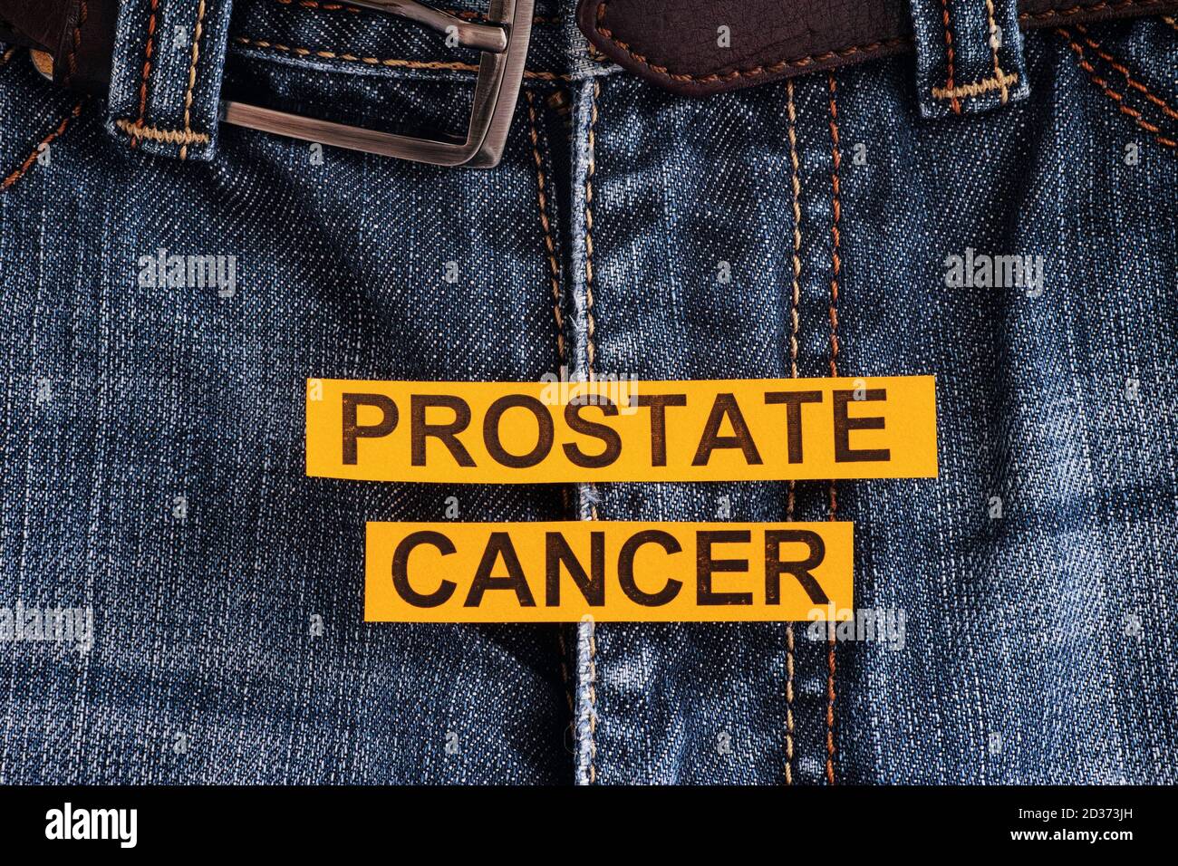 Pezzi di carta gialla con le parole cancro della prostata. Primo piano. Foto Stock