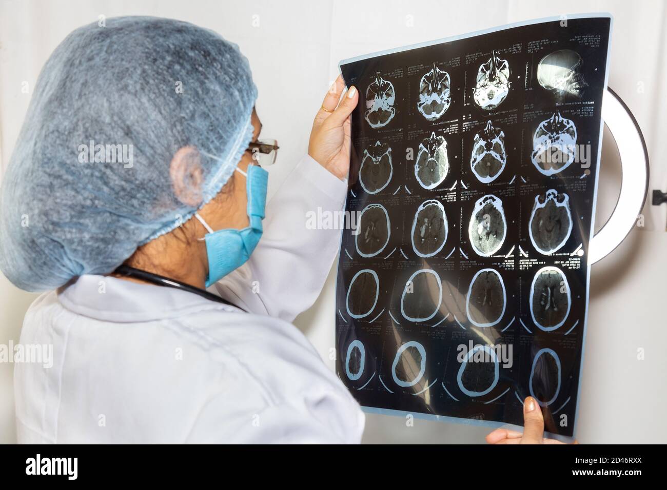 Neurologo femminile indiano esamina una piastra di scansione TC cerebrale a. una clinica sanitaria Foto Stock