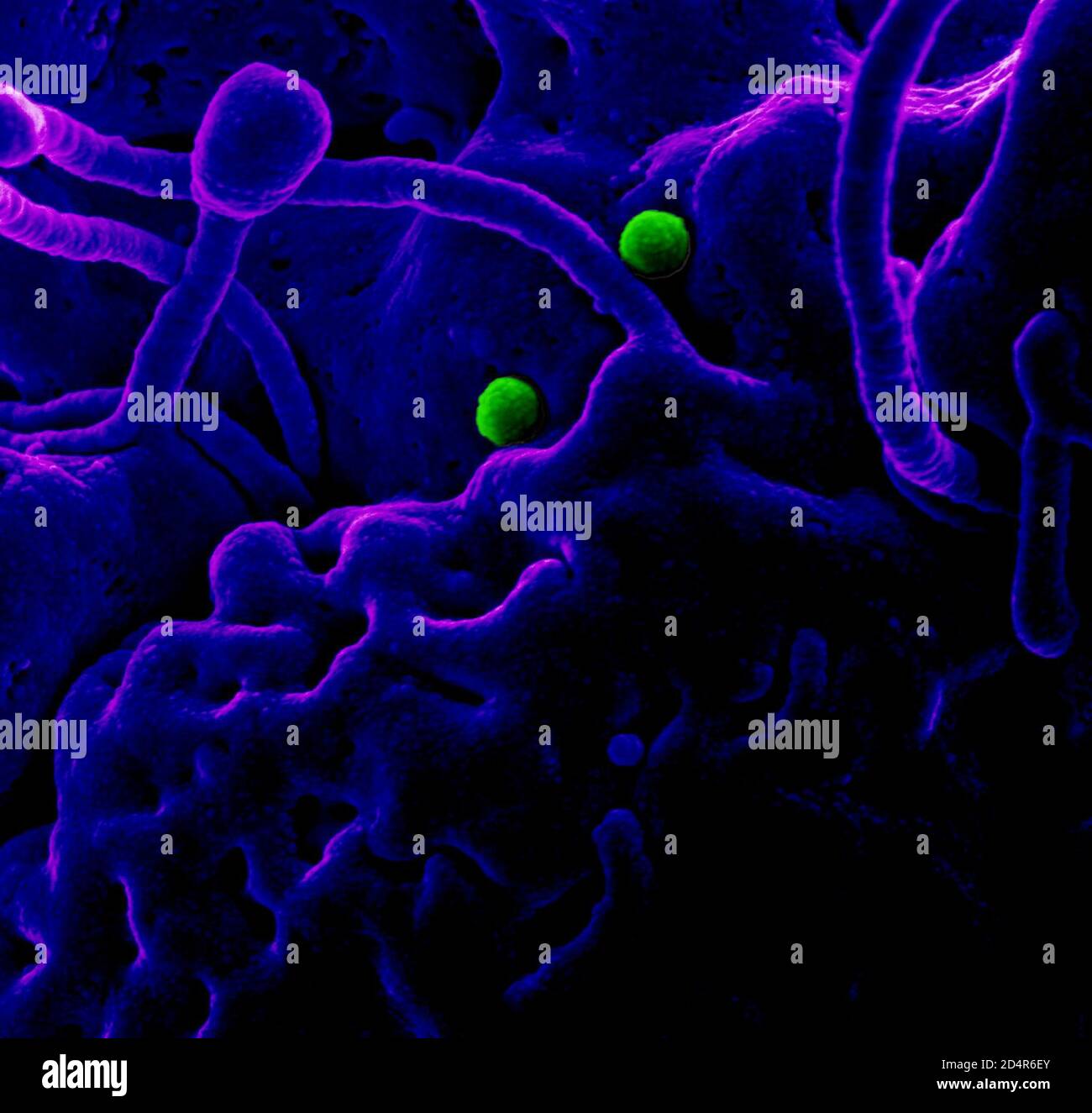Particelle DI MERS-COV su cellule epiteliali di cammello ; particules MERS-COV sur des cellules épithéliales de chameau Foto Stock