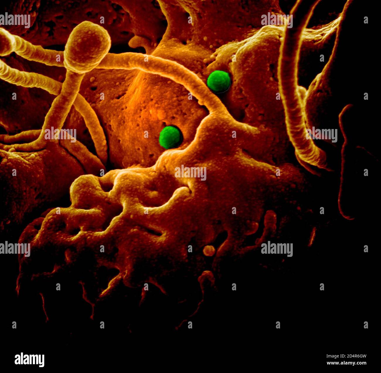 Particelle DI MERS-COV su cellule epiteliali di cammello ; particules MERS-COV sur des cellules épithéliales de chameau Foto Stock