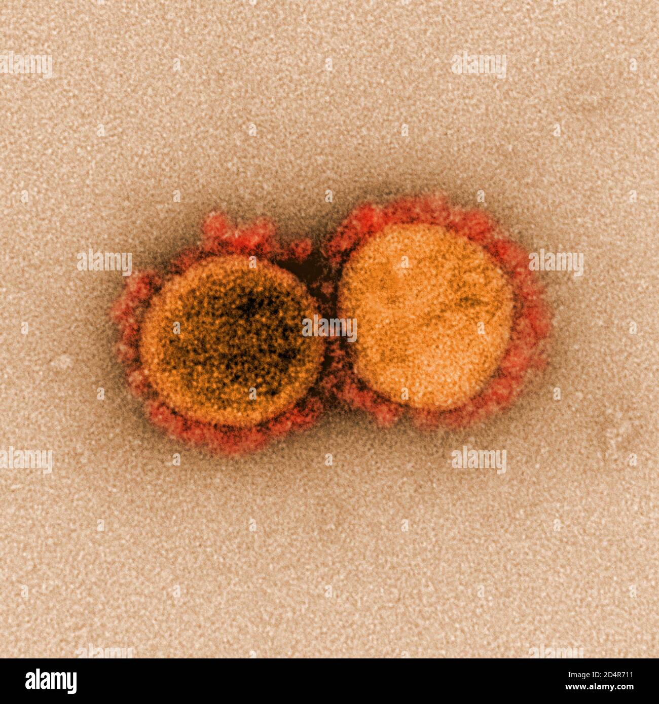 Questa immagine al microscopio elettronico a trasmissione mostra SARS-COV-2, noto anche come 2019-nCoV, il virus che causa COVID-1, isolato da un paziente negli Stati Uniti Foto Stock