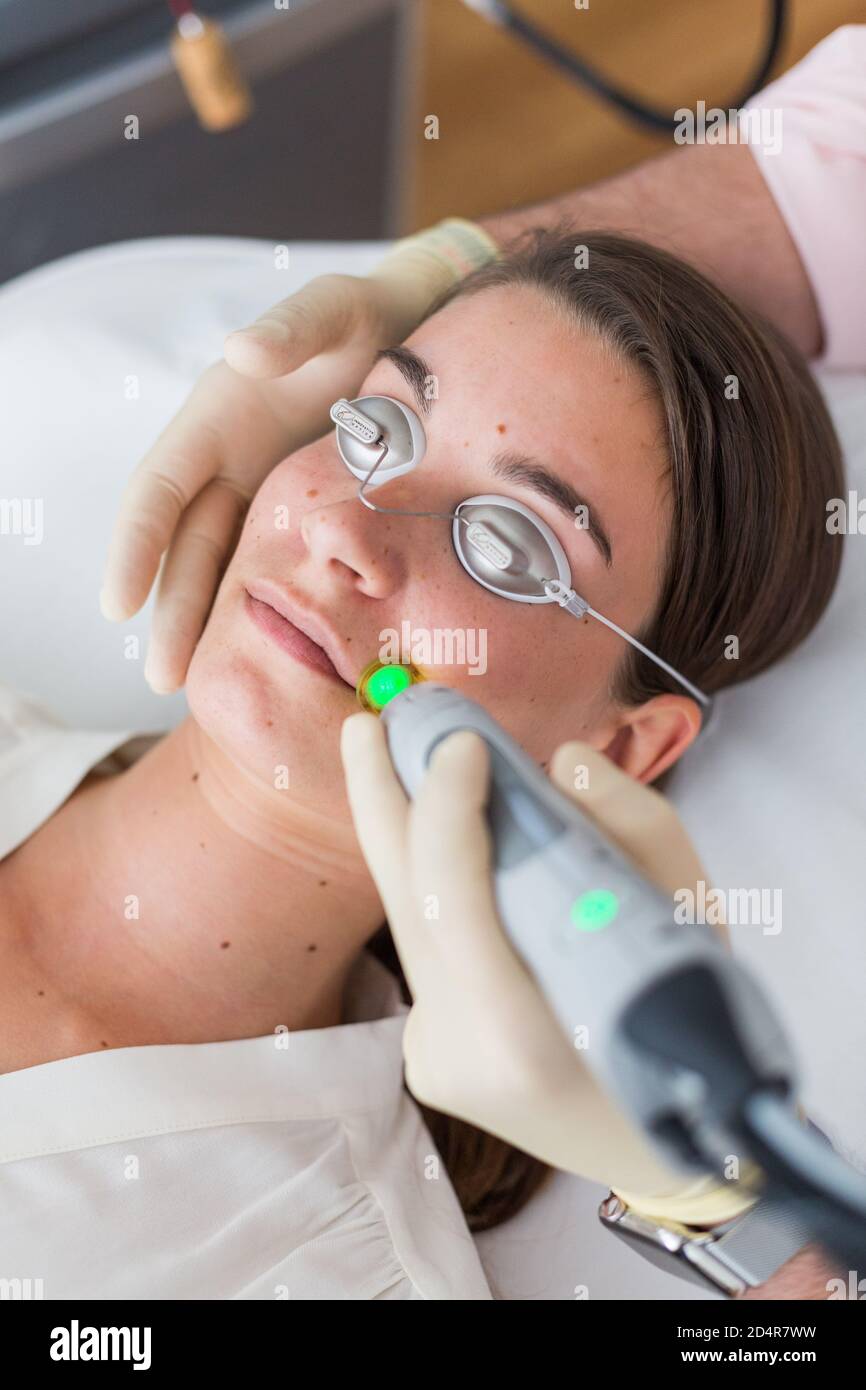 Permanant depilazione con laser. Foto Stock