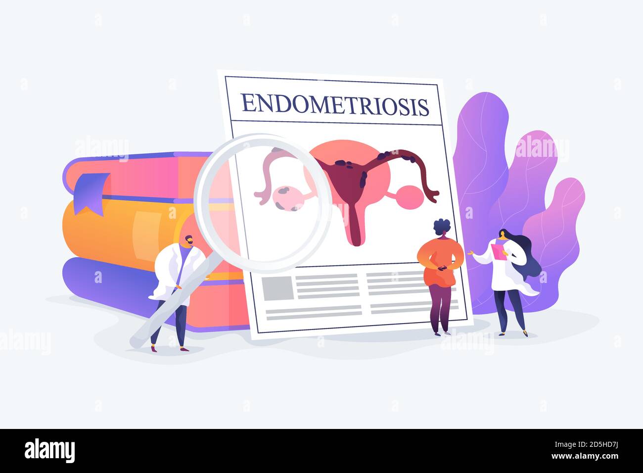 Illustrazione vettoriale del concetto di endometriosi Illustrazione Vettoriale