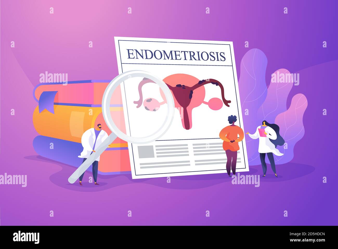 Illustrazione vettoriale del concetto di endometriosi Illustrazione Vettoriale