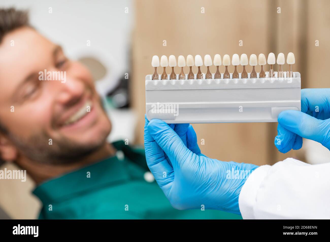 campione di colore dei denti della tavolozza per determinare l'ombreggiatura sui denti del paziente. Lo stomatologo userà il colore dei denti per fare veneer, corone e dentellature Foto Stock