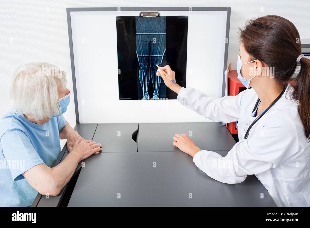 Reumatologo che consulta un paziente anziano puntando ai raggi X dell'articolazione del ginocchio. Artrite e malattia delle articolazioni delle gambe Foto Stock