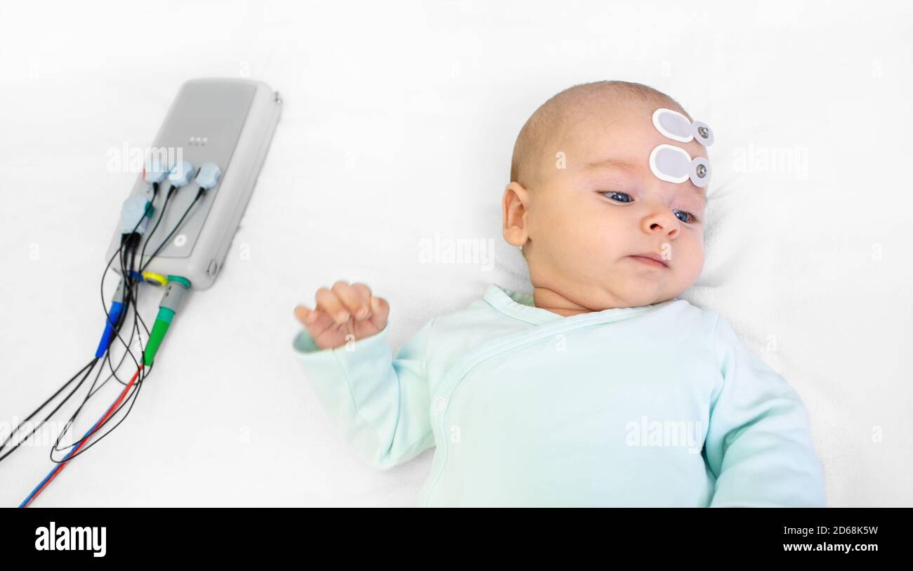 Screening e diagnosi dell'udito neonato in ospedale. Bambino che ha lo screening uditivo con elettrodi speciali sulla testa e sull'orecchio Foto Stock