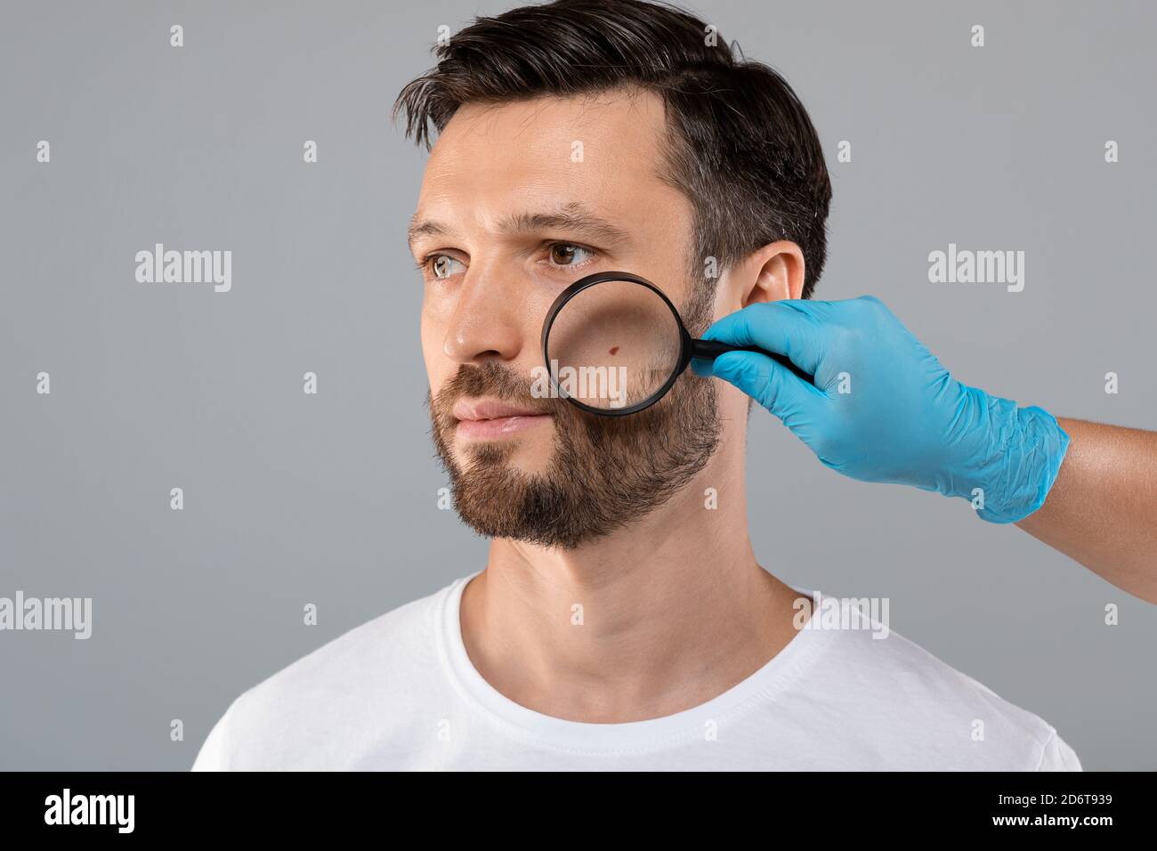 Medico mano controllo viso pelle di uomo con Dermatoscope Foto Stock