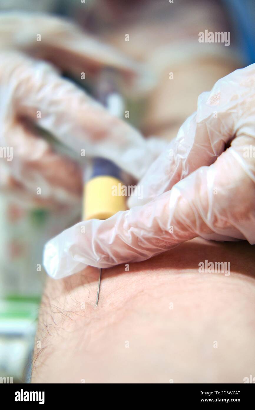 Il medico prende il sangue da una vena dell'uomo con covid, lifestyle Foto Stock