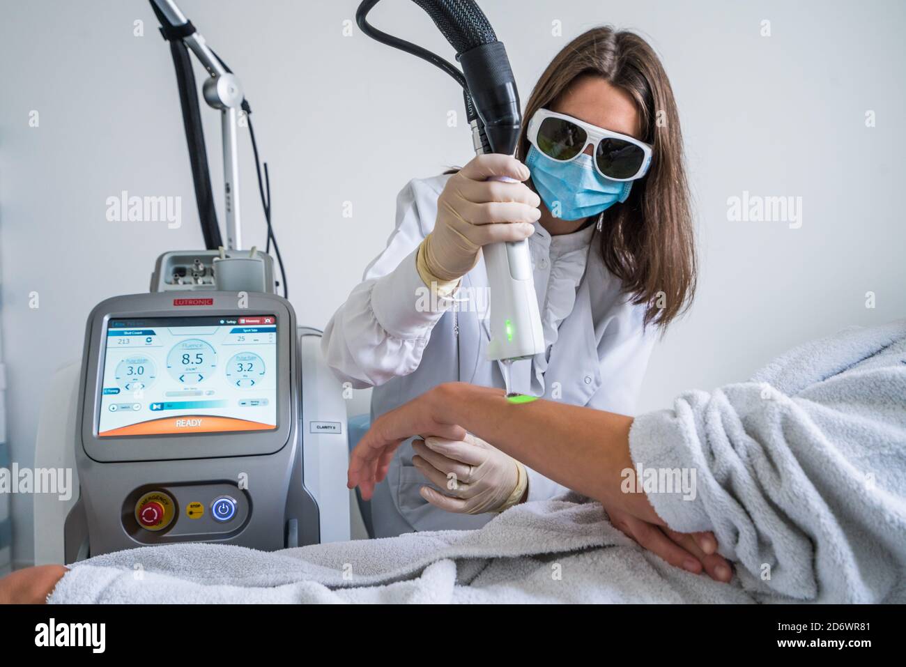 Rimozione permanente dei capelli laser delle mani e degli avambracci, Cosem centro Parigi. Foto Stock