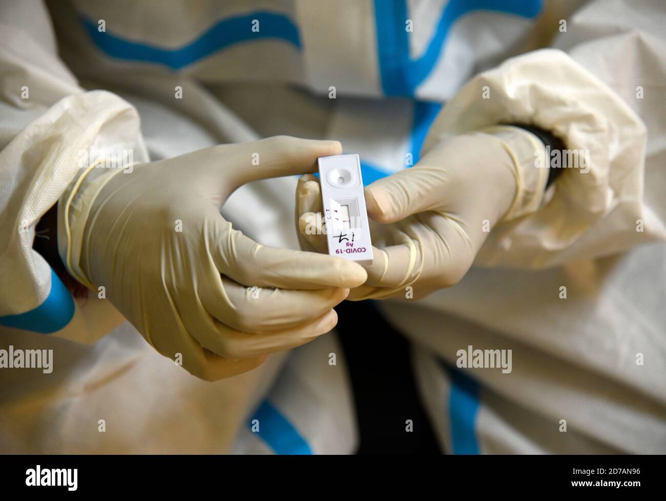 Guwahati, Assam, India. 21 Ott 2020. Un operatore sanitario che mostra un risultato negativo del test rapido dell'antigene (RAT) Covid-19, in un centro di raccolta dei tamponi, in vista del festival durga puja, a Guwahati, India, il 21 ottobre 2020. Fino all'ottobre 20 sono stati analizzati complessivamente 9, 72, 00,379 campioni. Secondo la Johns Hopkins University, che ha compilato dati COVID-19 da tutto il mondo, il bilancio delle vittime dell'India è il terzo peggiore. Credit: David Talukdar/ZUMA Wire/Alamy Live News Foto Stock