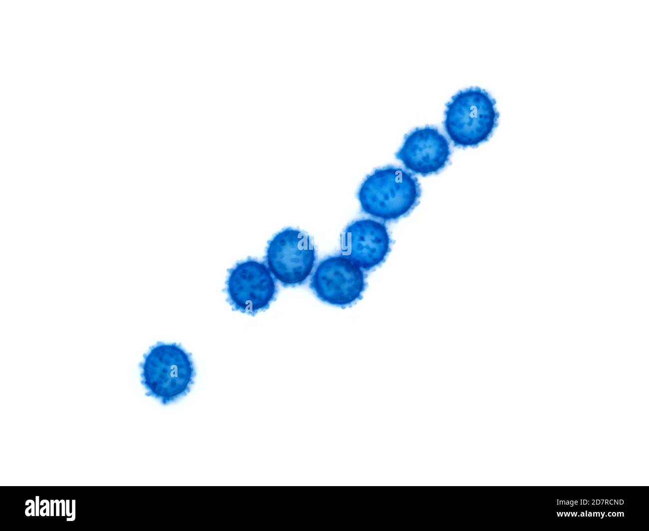 Russula a gambo corto (Russula brevipes) spore sotto il microscopio, il campo visivo orizzontale è di circa 117 micron Foto Stock